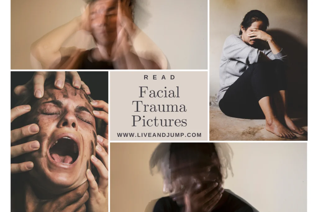 https://liveandjump.com/facial-trauma-pictures-in-2024/